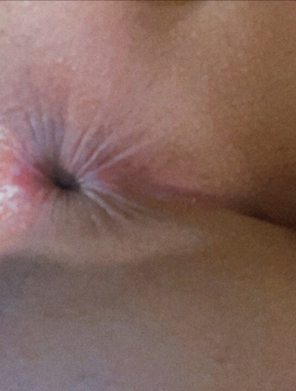 Lisett Onlyfans pictures